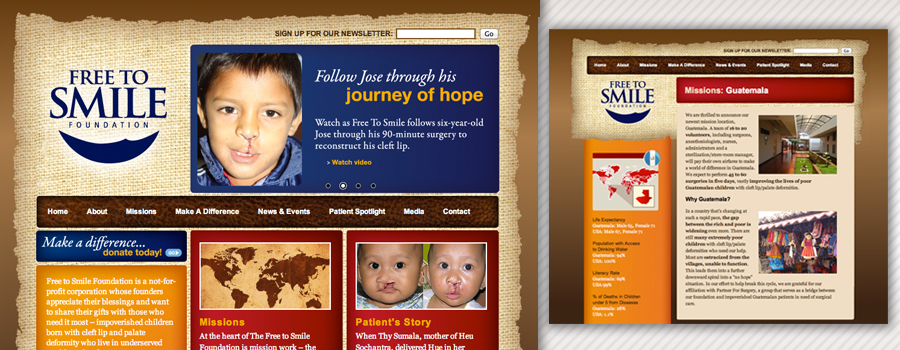 free to smile, smile, cleft